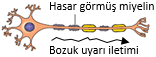 MS hastası nöronu